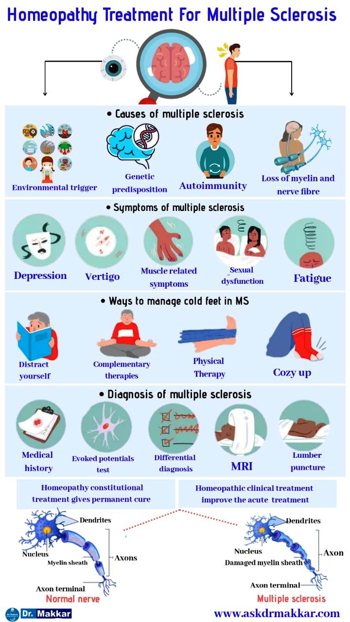 Multiple Sclerosisomeopathic Treatment Known As MS Demylation Nerve Disease